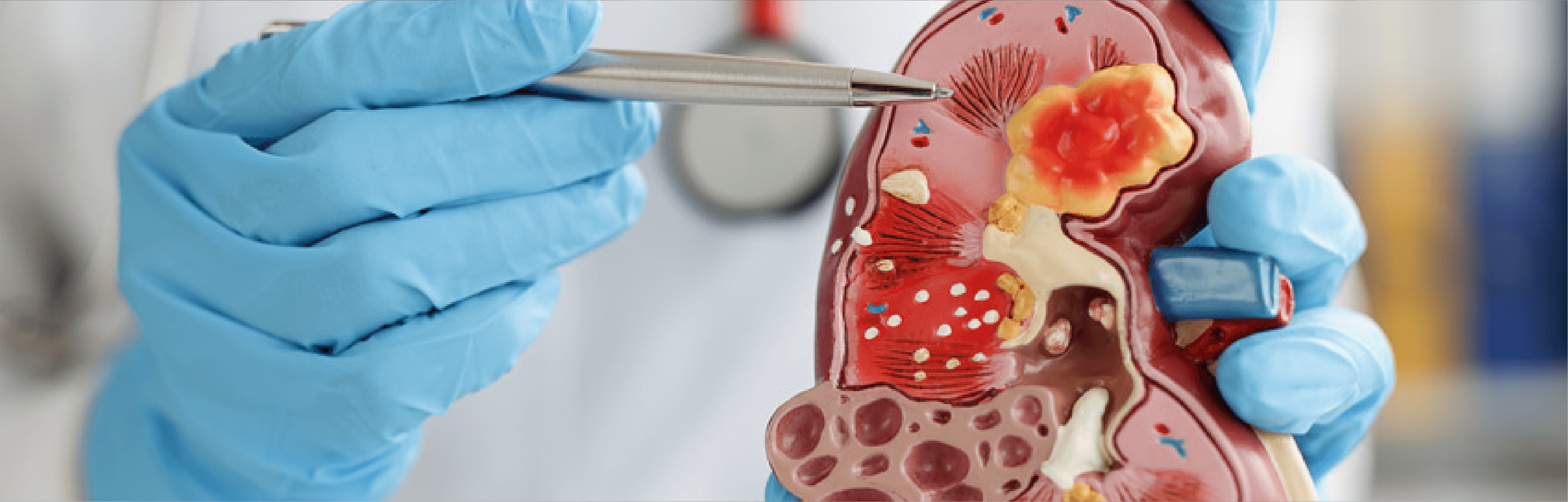 Médico revisando estudios de imagen relacionados con riñones