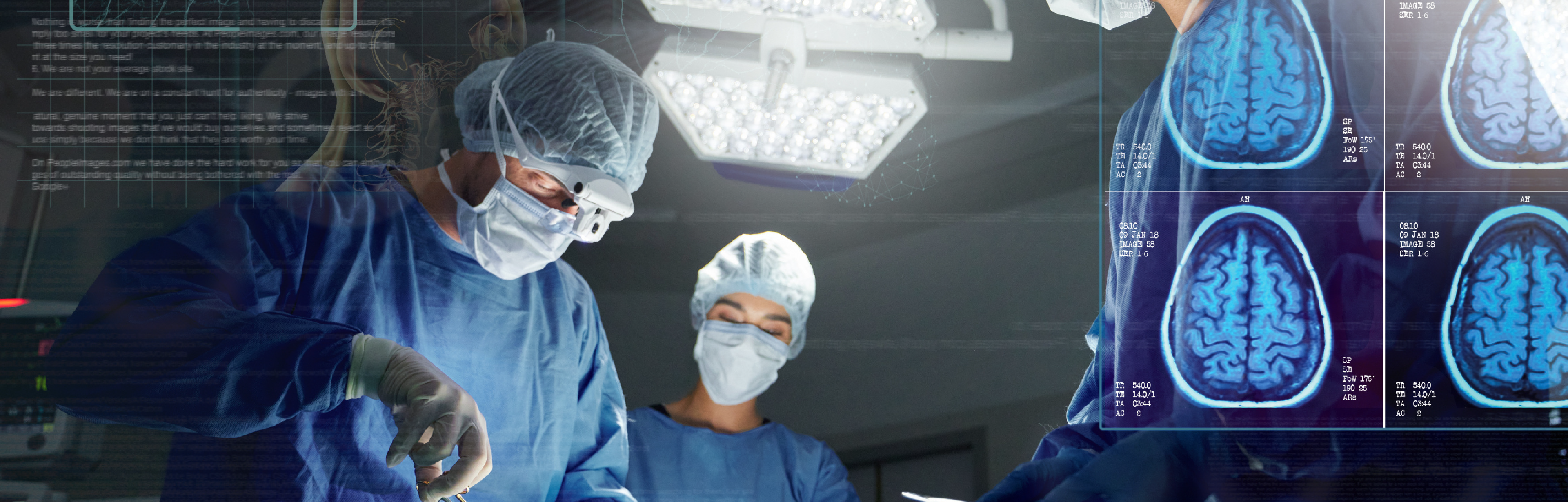 Equipo de neurocirujanos en quirófano con estudios cerebrales en pantalla